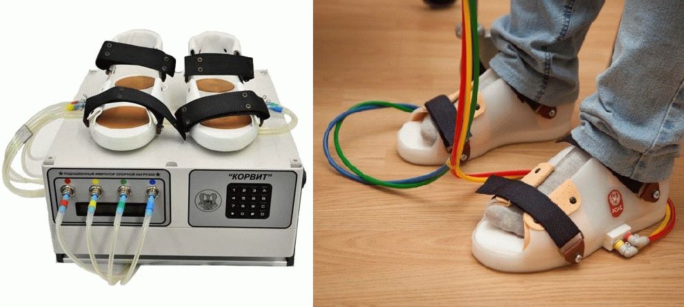 Рады сообщить,что в отделении НПЦ ДП на улице ул. Гарибальди, д. 8к6 появился аппарат «КОРВИТ» «космические ботинки»